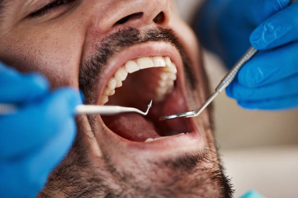 Best Emergency Dentist for Knocked-Out Tooth in Marshall, VA