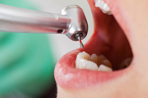 Best Orthodontic Emergency Dentist in Marshall, VA